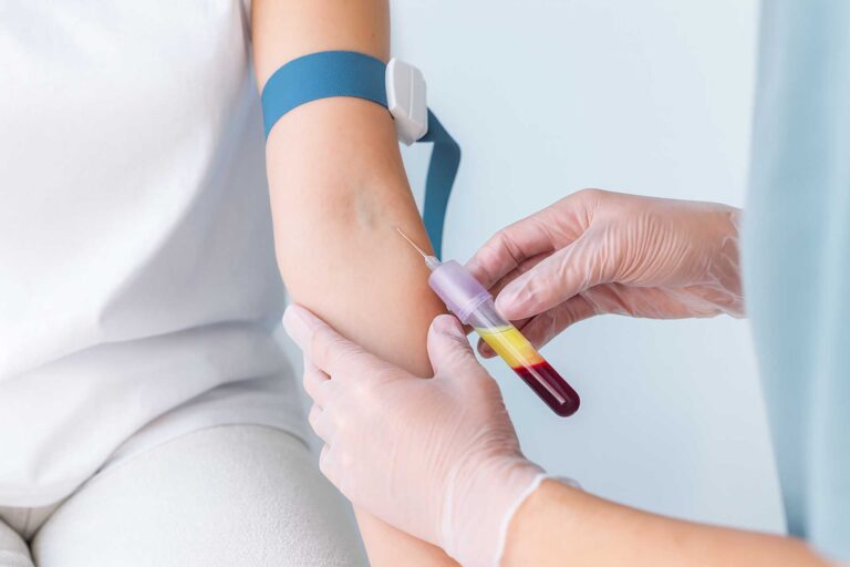 A plazmaadás menete